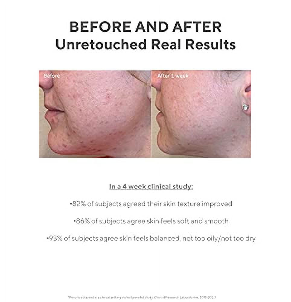 Daily Clarifying Peel Exfoliating Peel Solution Resurfacing Retinoid AHA BHA Liquid Skin-Smoothing Retinoid Salicylic Acid Glycolic Acid Peel for Face 3.2 Fl Oz C404