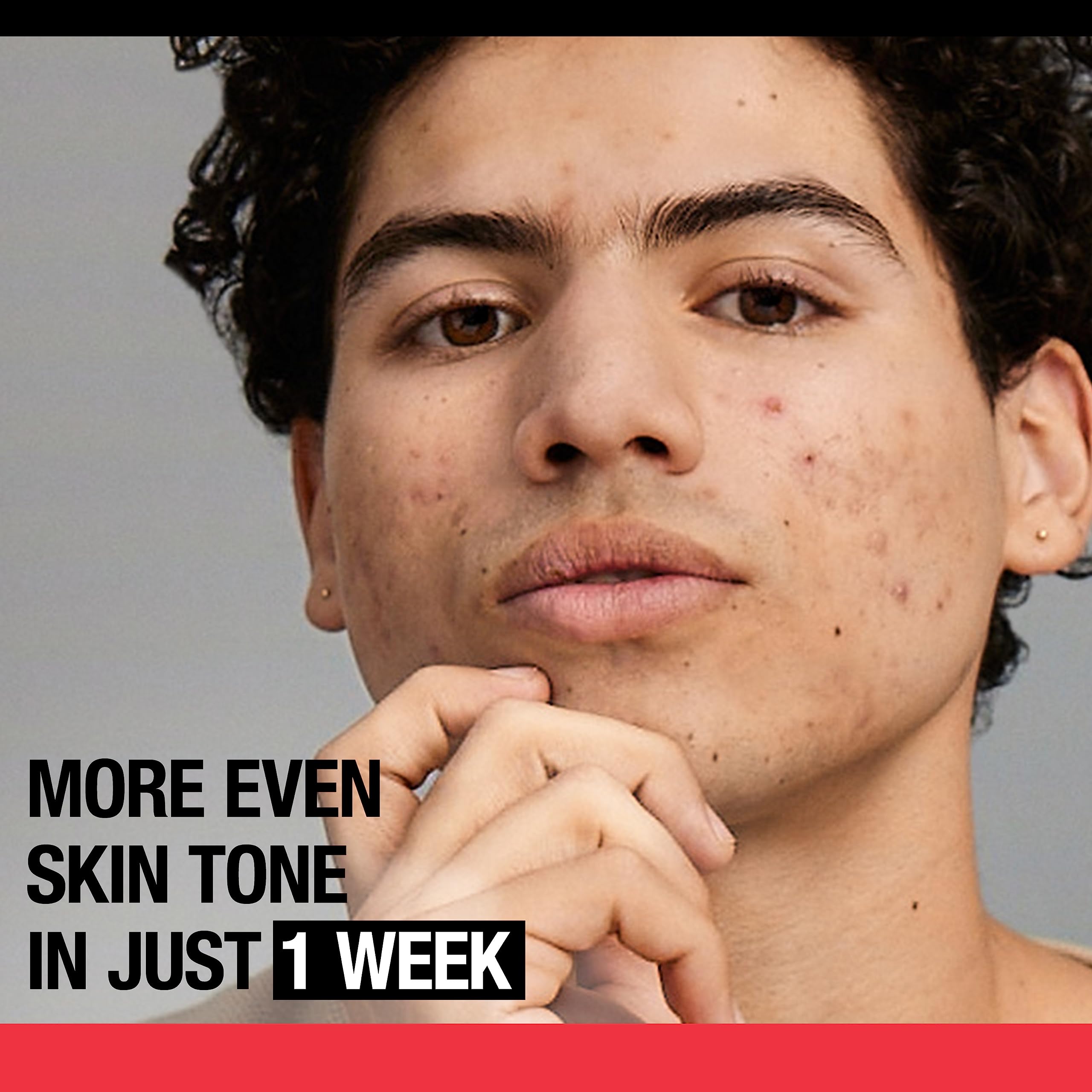 Stubborn Marks Pm Treatment With Retinol Sa, Face-Exfoliating Treatment, Oil-Free, Non-Comedogenic, Unscent H30704